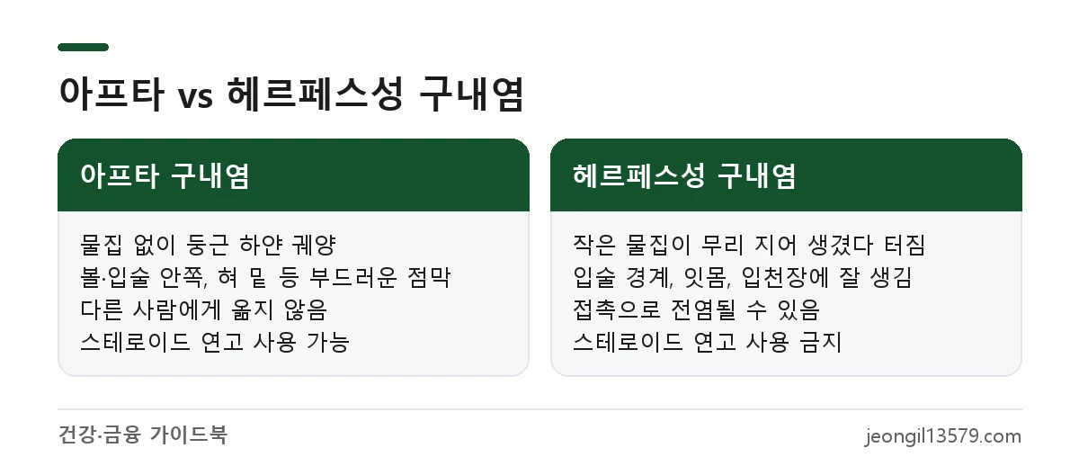 만성 구내염 중 아프타 구내염과 헤르페스성 구내염의 모양, 위치, 전염성, 연고 사용 차이 비교
